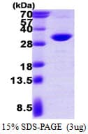 Human PSME2 Protein (Recombinant His)