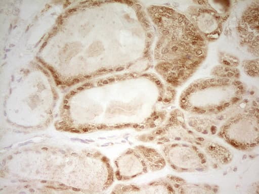 Monoclonal Mouse anti-Human HMG20A Antibody (clone OTI1C2, aa1-281, IHC, WB)
