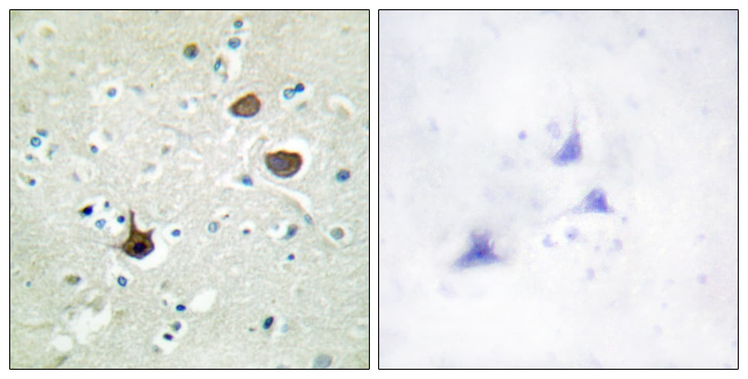CXCR4 Antibody (phospho-Ser339)