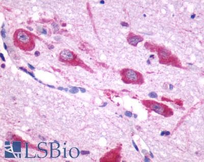 PathPlus™ Polyclonal Rabbit anti-Human CHRM5 / M5 Antibody (Cytoplasmic Domain, IHC)