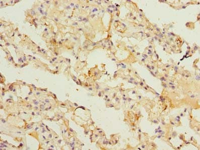 ARL11 Antibody