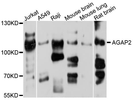 FBXO32 / Fbx32 Antibody