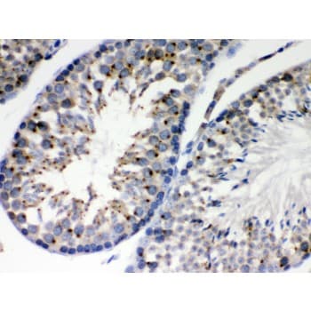 EBAG9 / RCAS1 Antibody (aa31-213)