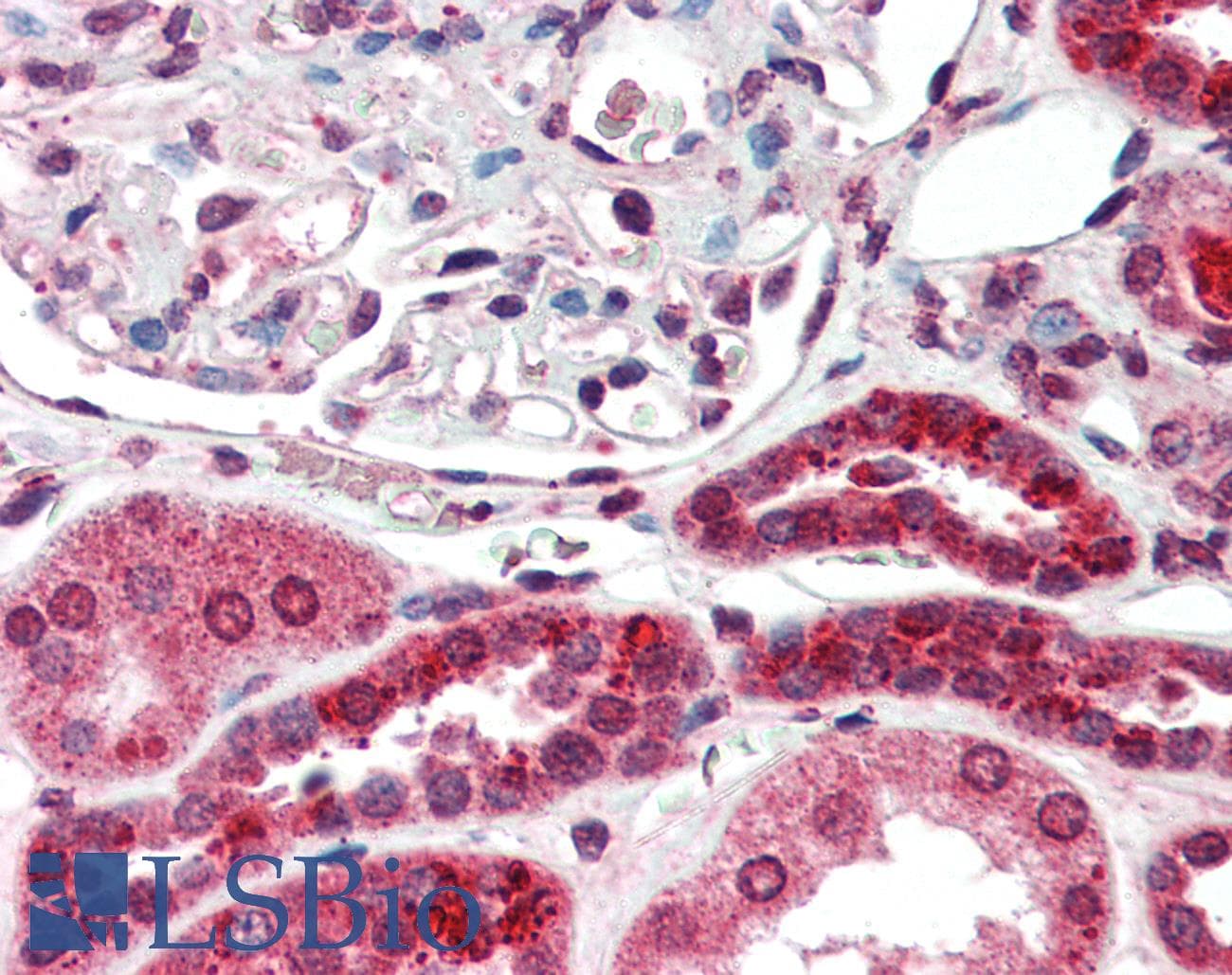 IHC-plus™ Mineralocorticoid Receptor Antibody (clone H10E4C9F)