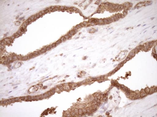 Monoclonal Mouse anti-Human HOXC10 Antibody (clone OTI5C10, aa1-262, IHC, WB)