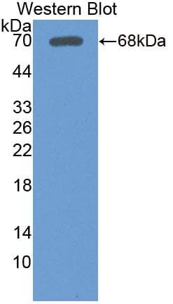 LSR / LISCH7 Antibody (aa335-589)