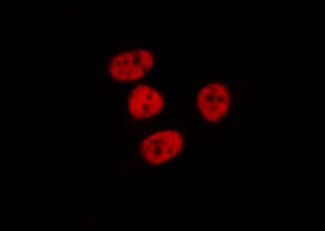 MGMT Antibody