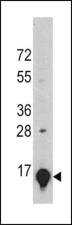 IHC-plus™ LGALS1 / Galectin 1 Antibody (clone 24CT661.4.3)