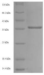 Mouse FCGR3 Protein (Recombinant 6His-SUMO, N-terminus)