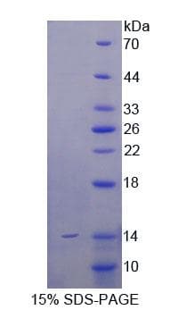 Mouse SFTPC / Surfactant Protein C (Recombinant His)