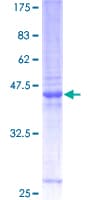Human ZMYM6 Protein (Recombinant GST)