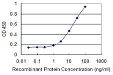 CAV3 / Caveolin 3 Antibody (clone 1B9)