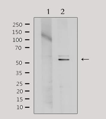Polyclonal Rabbit anti-Human TINF2 Antibody (IF, WB)