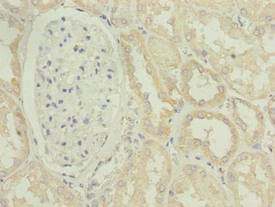 POGZ Antibody