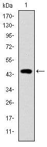 Monoclonal Mouse anti-Human TNNI2 Antibody (clone 2F12A8, IHC, WB)