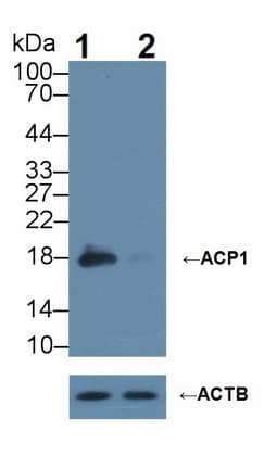ACP1 / Acid Phosphatase Antibody (aa1-158)