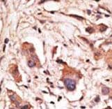 MAGED1 / NRAGE Antibody (aa426-456)