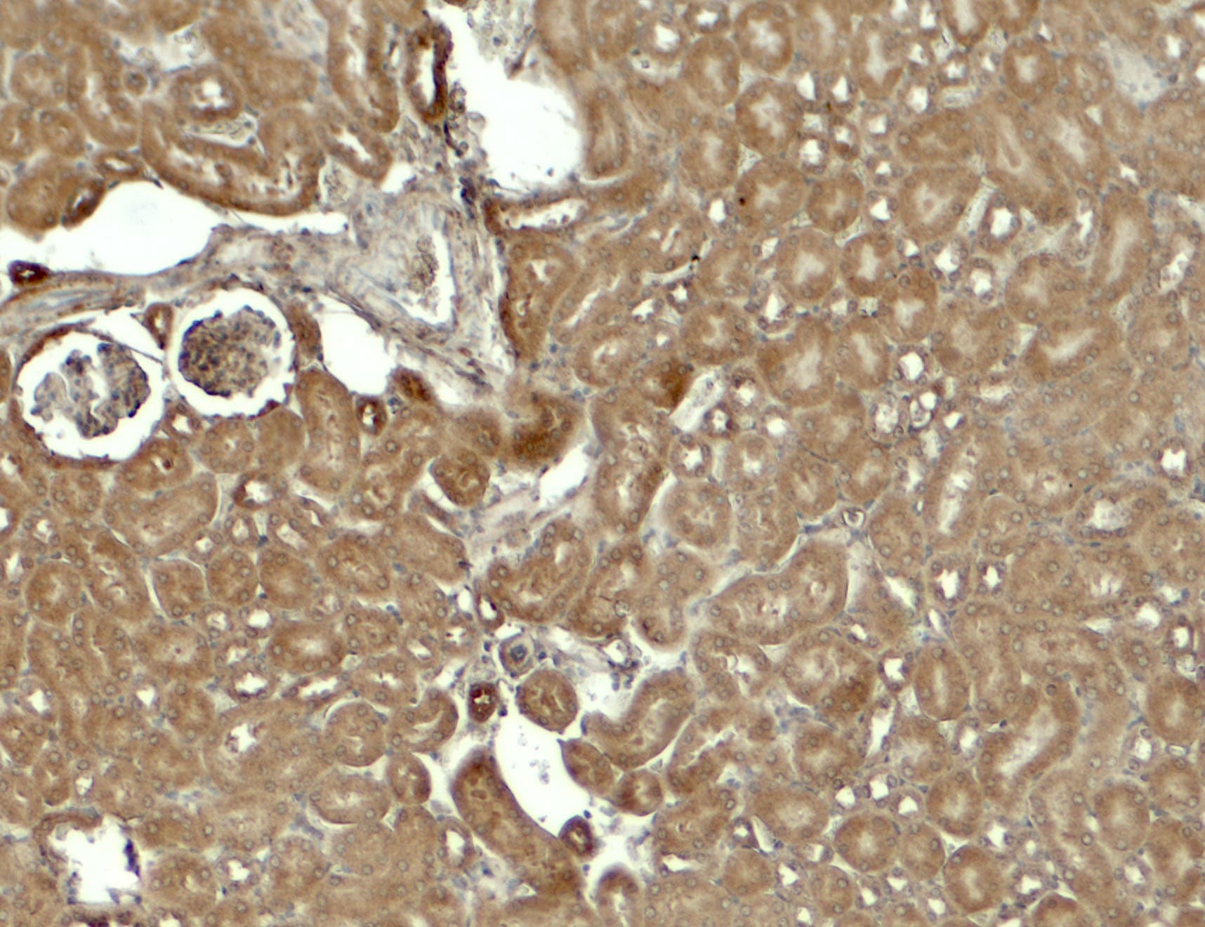 Polyclonal Rabbit anti-Human SESN2 / HI95 Antibody (IHC, IF, WB)