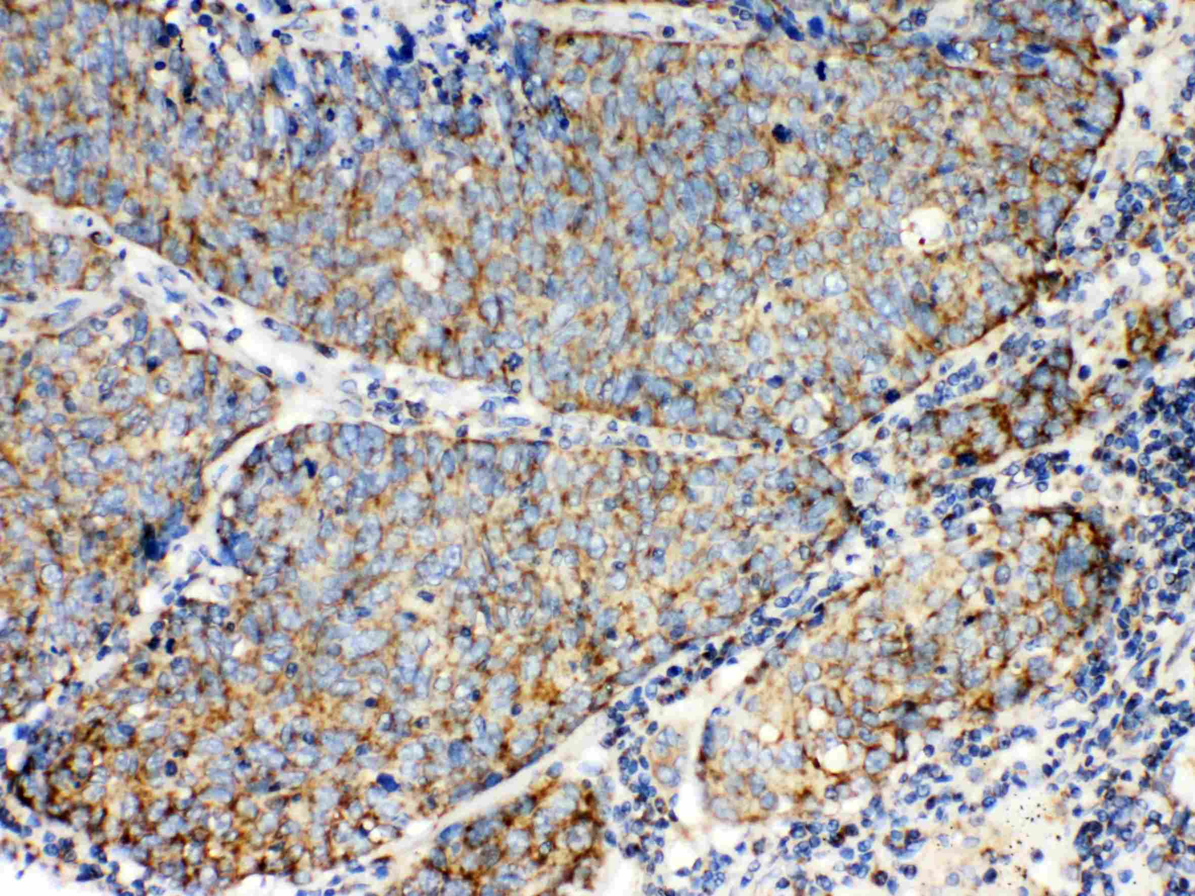 Polyclonal Rabbit anti-Human TECTA Antibody (IHC, WB)