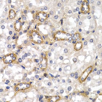 CD38 Antibody