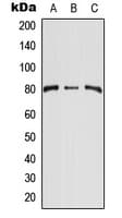 TEM1 / CD248 Antibody (Internal)