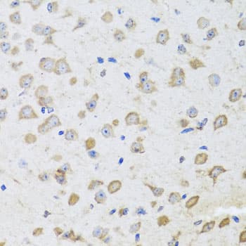 IHC-plus™ ARL6 Antibody