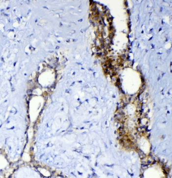 Polyclonal Rabbit anti-Human ABCC2 / MRP2 Antibody (IHC, WB)