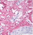 Monoclonal Mouse anti-Human COL5A1 / Collagen V Alpha 1 Antibody (clone 18G5, IHC, WB)