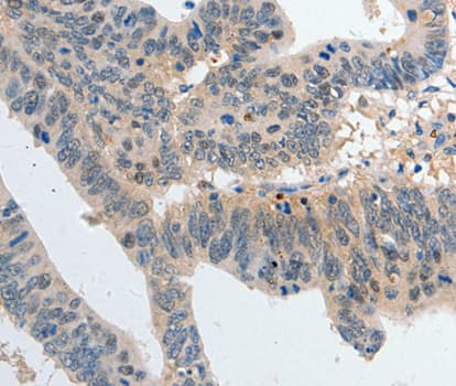 Polyclonal Rabbit anti-Human P2RY6 / P2Y6 Antibody (IHC, WB)