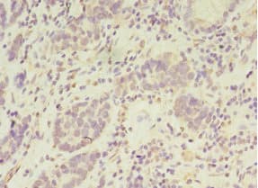 PSKH2 Antibody