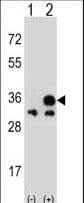 IHC-plus™ Polyclonal Rabbit anti-Human VDAC1 / PORIN Antibody (aa1-30, IHC, WB)