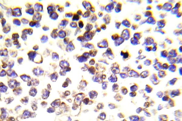 Polyclonal Rabbit anti-Human H2AFX / H2AX Antibody (Glu145, IHC, WB)