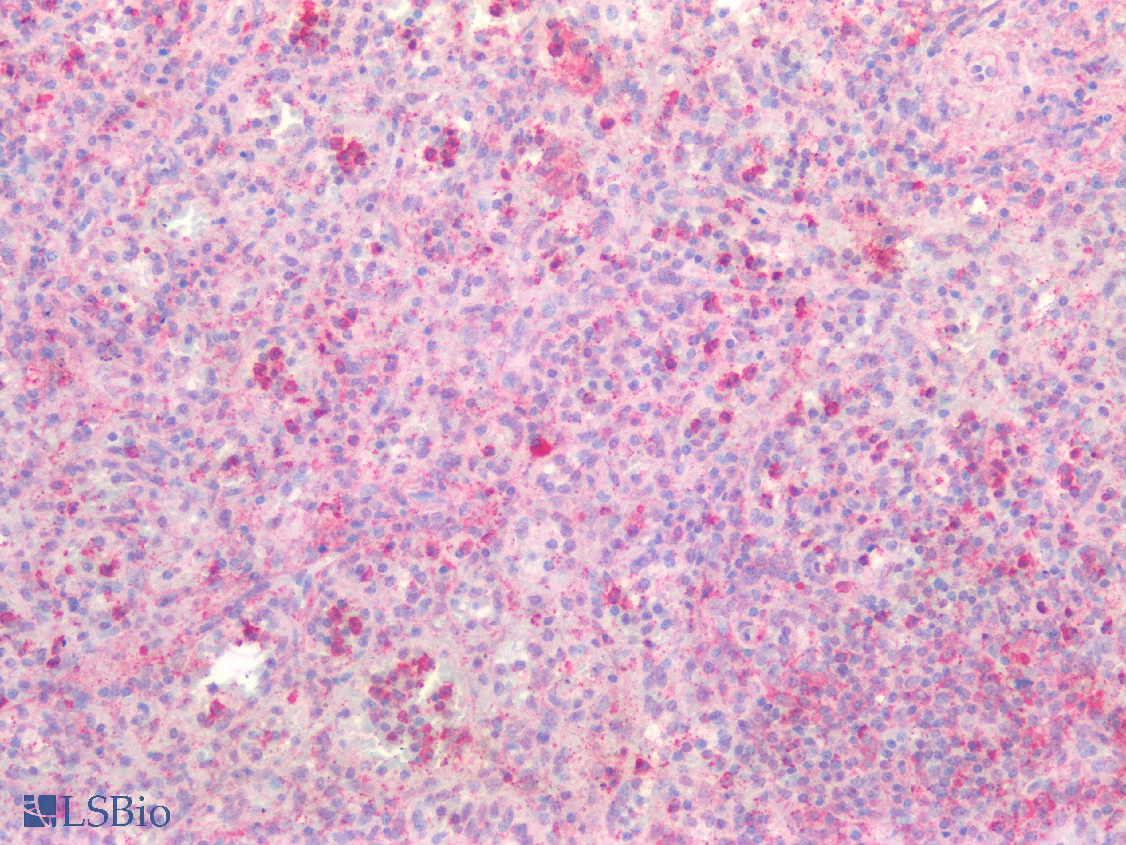 PathPlus™ TNFRSF14 / CD270 / HVEM Antibody