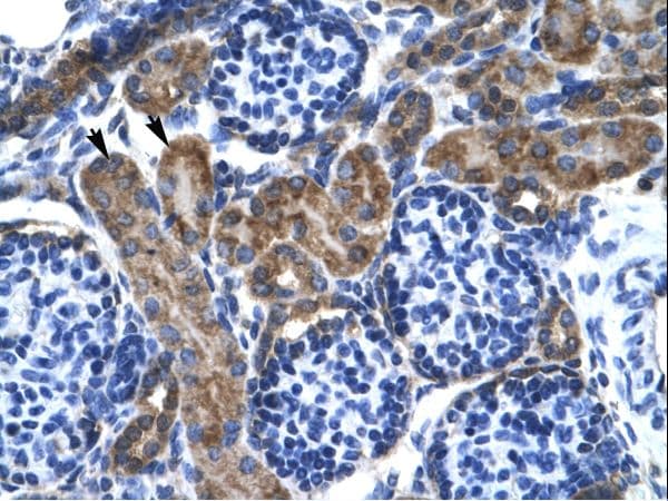 Polyclonal Rabbit anti-Human KCNQ2 Antibody (aa189-238, IHC, WB)