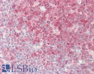 PathPlus™ Monoclonal Mouse anti-Human CASP3 / Caspase 3 Antibody (clone ABM1C12, IHC, WB)