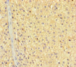 ZNF404 Antibody