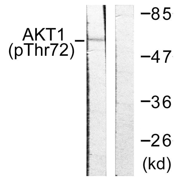 Polyclonal Rabbit anti-Human AKT1 Antibody (phospho-Thr72, IHC, WB)