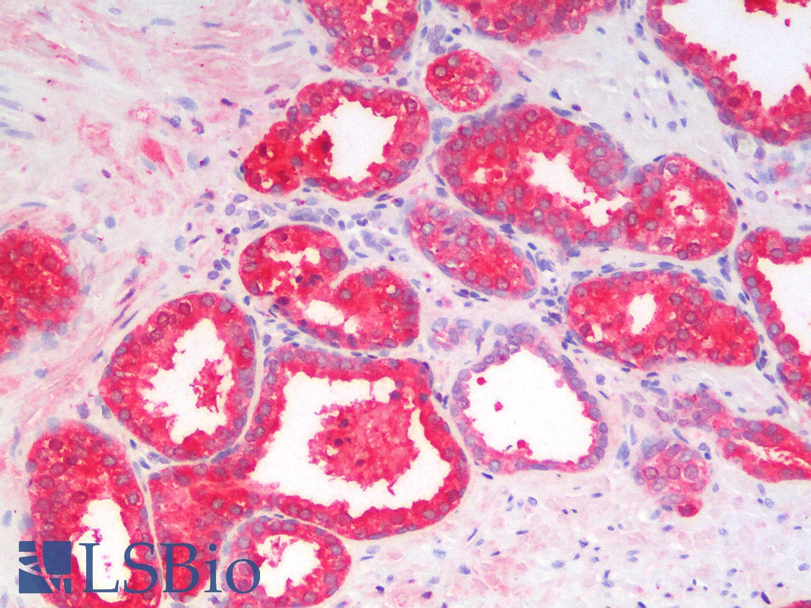 PathPlus™ Recombinant Monoclonal Rabbit anti-Human KLK3 / PSA Antibody (clone KLK3/2871R, IHC)