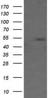 MDM4 / MDMX Antibody (clone OTI2D11)