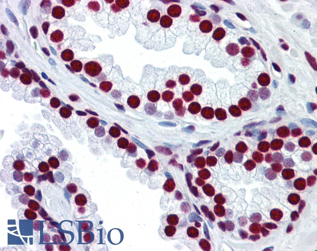 HNRPM / HNRNPM Antibody (N-Terminus)