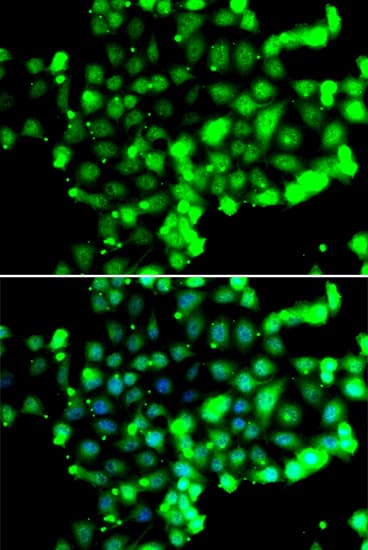 FASTK / FAST Antibody