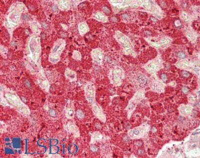 IHC-plus™ Polyclonal Rabbit anti-Human PPARA / PPAR Alpha Antibody (IHC, WB)