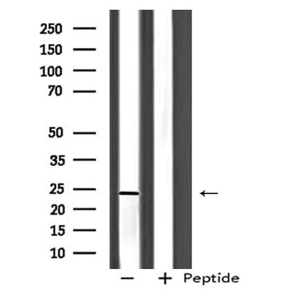 Polyclonal Rabbit anti-Human BOK Antibody (WB)