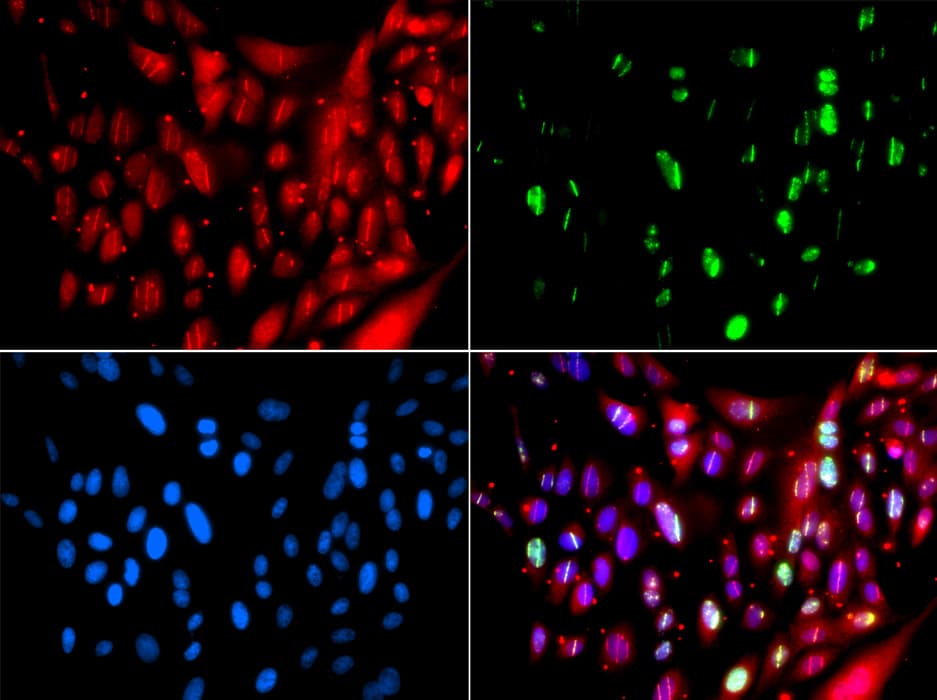 UIMC1 / RAP80 Antibody