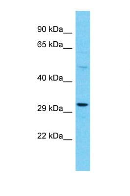 Polyclonal Rabbit anti-Human OR10A4 Antibody (C-Terminus, WB)