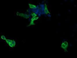 ERBB2 / HER2 Antibody (aa676-1255, clone OTI5F6, Carrier-free)