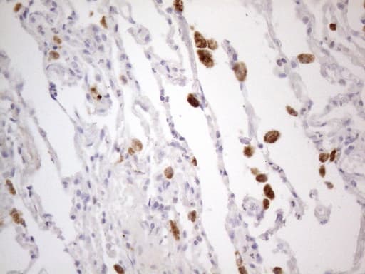 DJ858B16.2 / PISD Antibody (aa80-340, clone OTI4G5, Carrier-free)