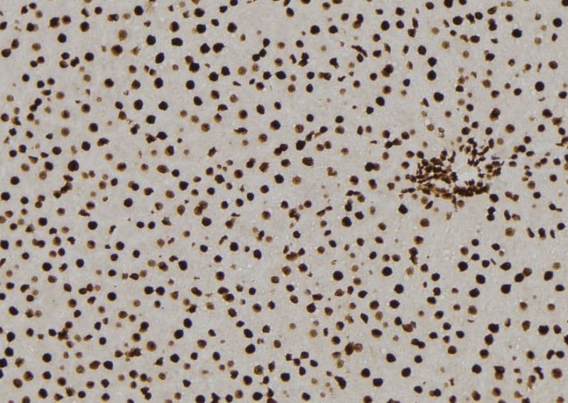NQO2 Antibody