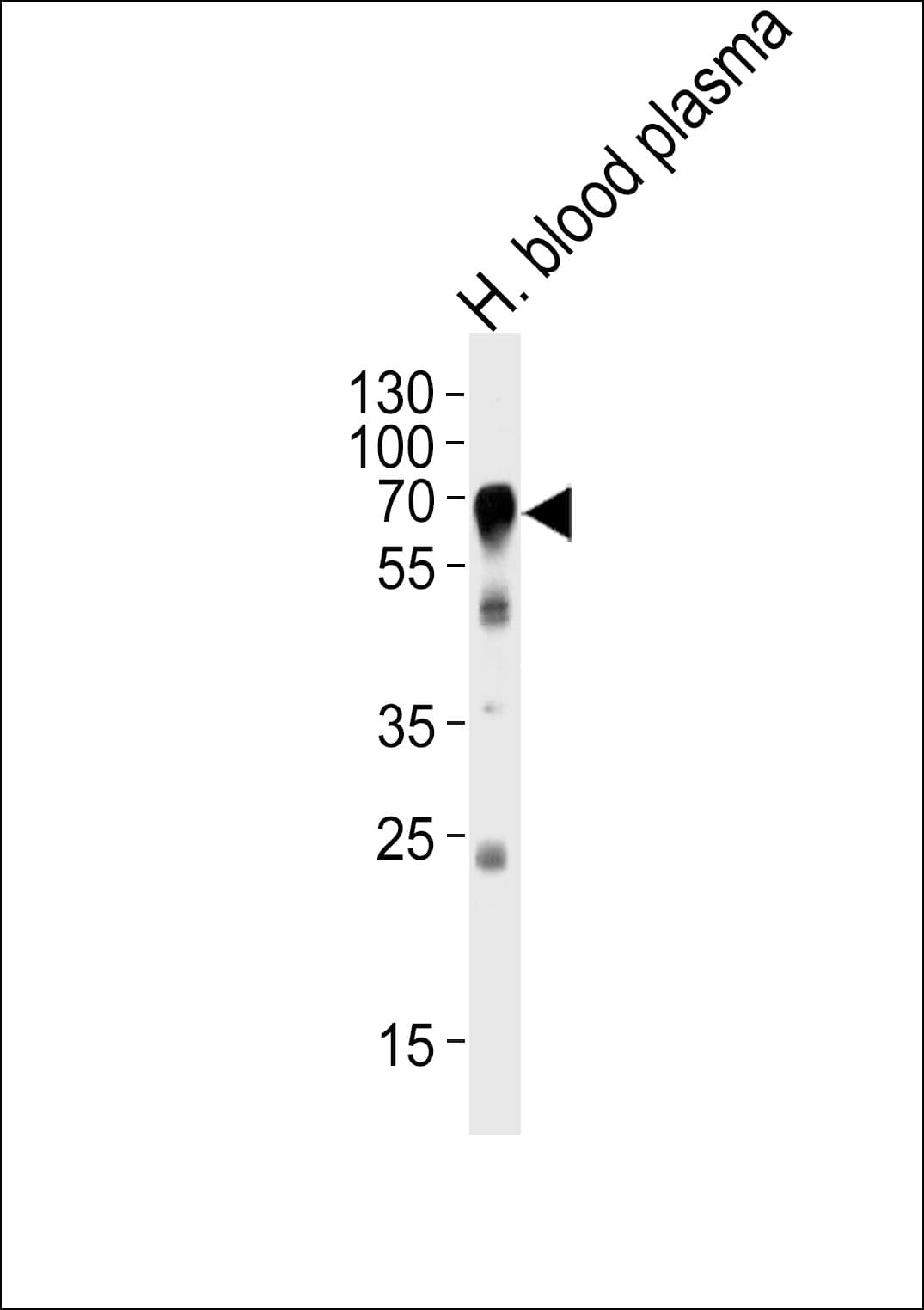 HPX / Hemopexin Antibody (aa200-227)