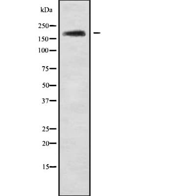 ABCA10 Antibody